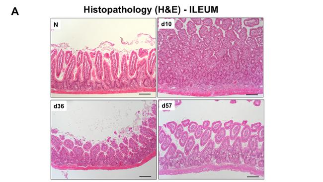 CD45R (B220) Antibody in Immunohistochemistry (IHC)