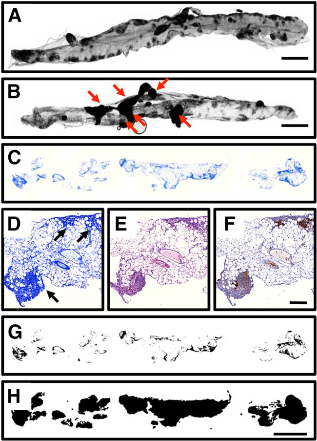 CD45 Antibody in Immunohistochemistry (IHC)