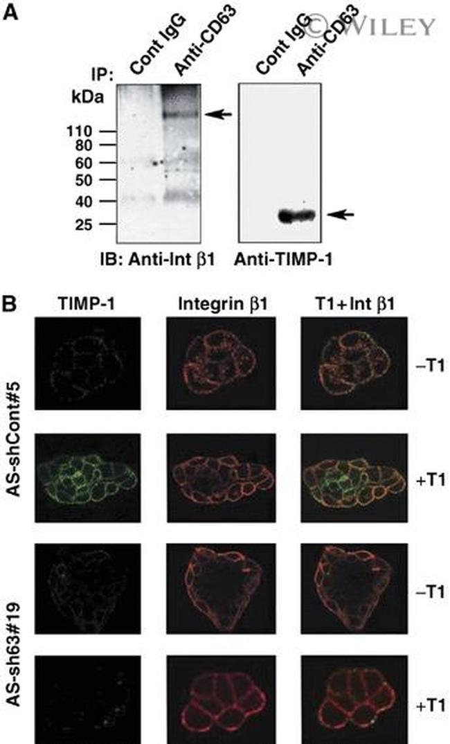 CD63 Antibody in Immunoprecipitation (IP)