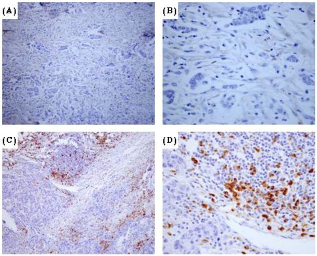 CD68 Antibody in Immunohistochemistry (IHC)