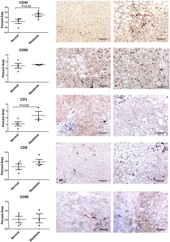 CD68 Antibody in Immunohistochemistry (Paraffin) (IHC (P))