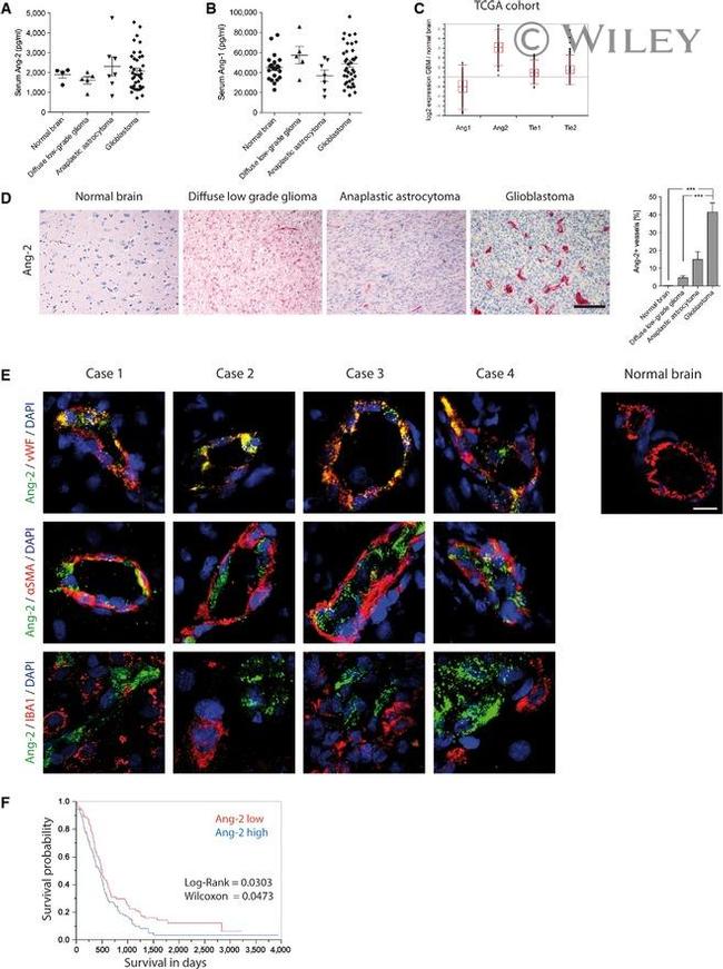 Angiopoietin 2 Antibody in Immunohistochemistry (IHC)