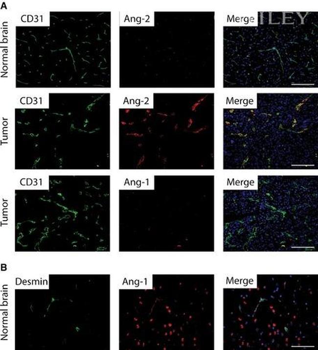 Angiopoietin 2 Antibody in Immunohistochemistry (IHC)