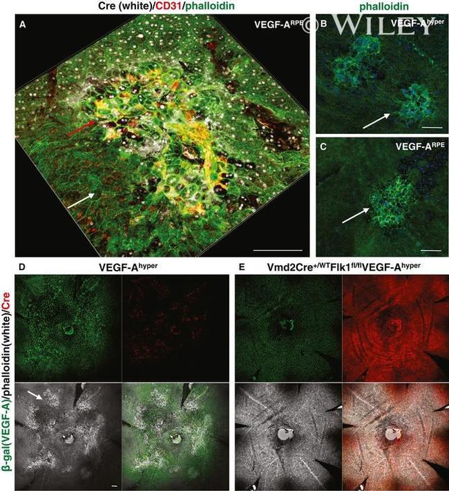 beta Galactosidase Antibody in Immunohistochemistry (IHC)