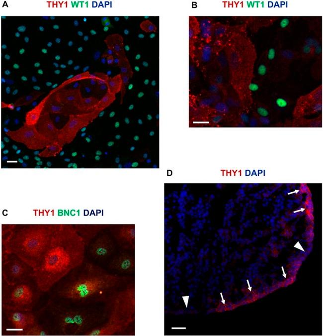 CD90 (Thy-1) Antibody in Immunocytochemistry, Immunohistochemistry (ICC/IF, IHC)