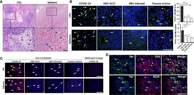 CD95 (APO-1/Fas) Antibody in Immunohistochemistry (IHC)