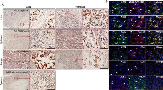 ACE2 Antibody in Immunohistochemistry (IHC)