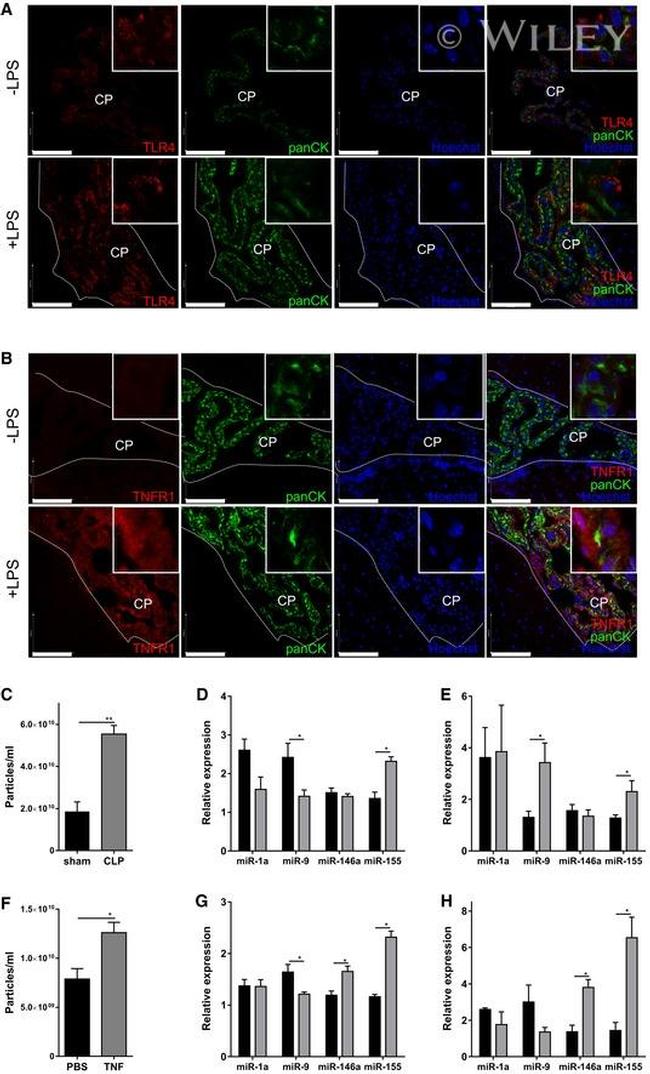 TLR4/MD-2 Complex Antibody in Immunohistochemistry (IHC)