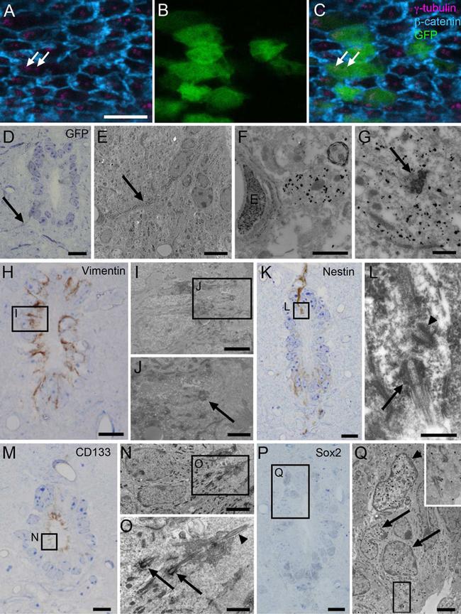 CD133 (Prominin-1) Antibody in Immunohistochemistry (IHC)