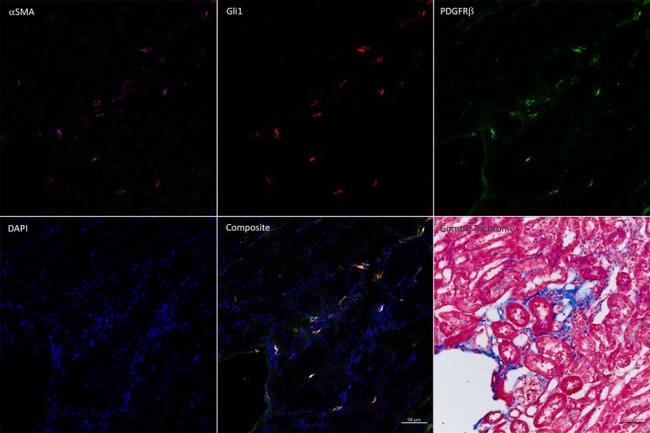 CD140b (PDGFRB) Antibody in Immunohistochemistry (IHC)