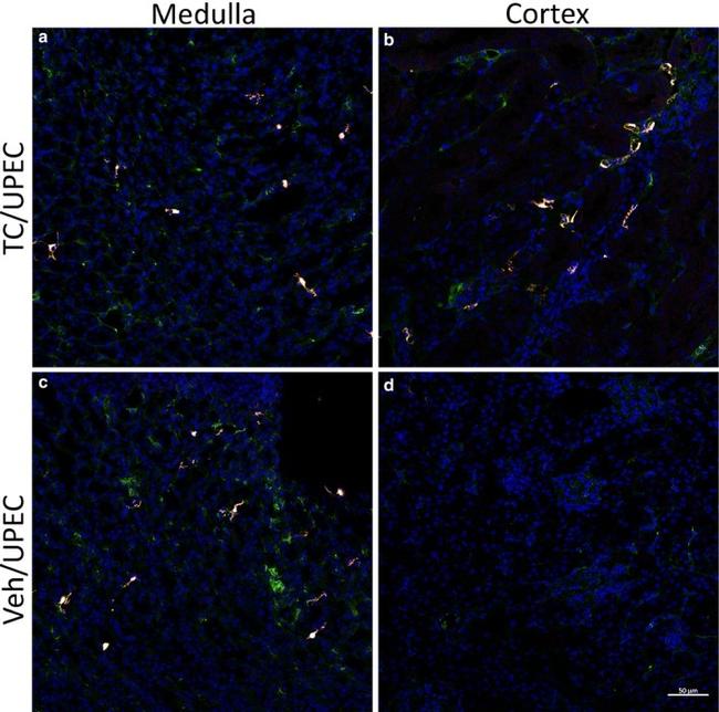 CD140b (PDGFRB) Antibody in Immunohistochemistry (IHC)