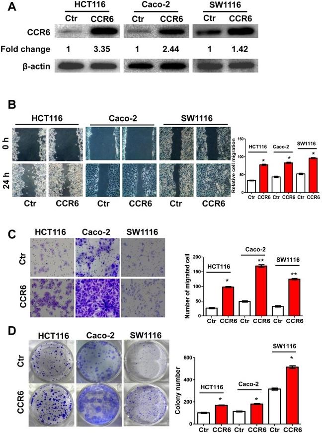 CD196 (CCR6) Antibody in Western Blot (WB)