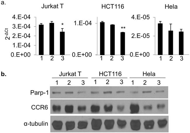 CD196 (CCR6) Antibody in Western Blot (WB)