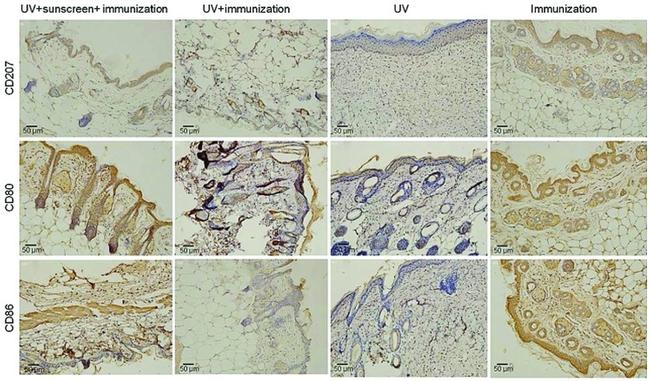 CD207 (Langerin) Antibody in Immunohistochemistry (IHC)