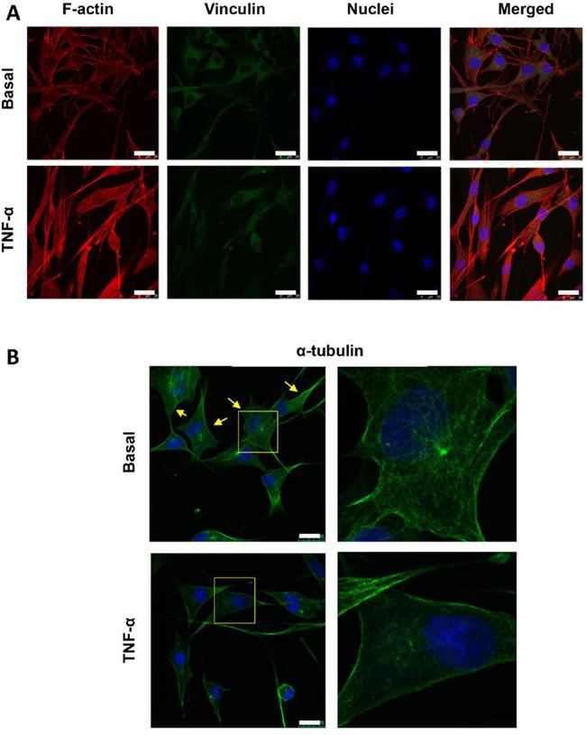 alpha Tubulin Antibody in Immunocytochemistry (ICC/IF)