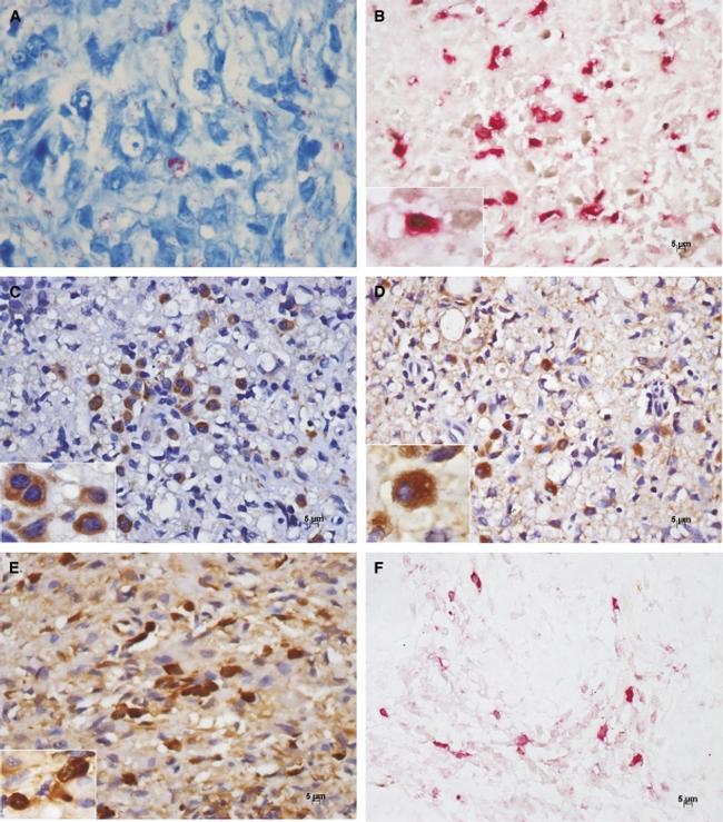 FOXP3 Antibody in Immunohistochemistry (IHC)