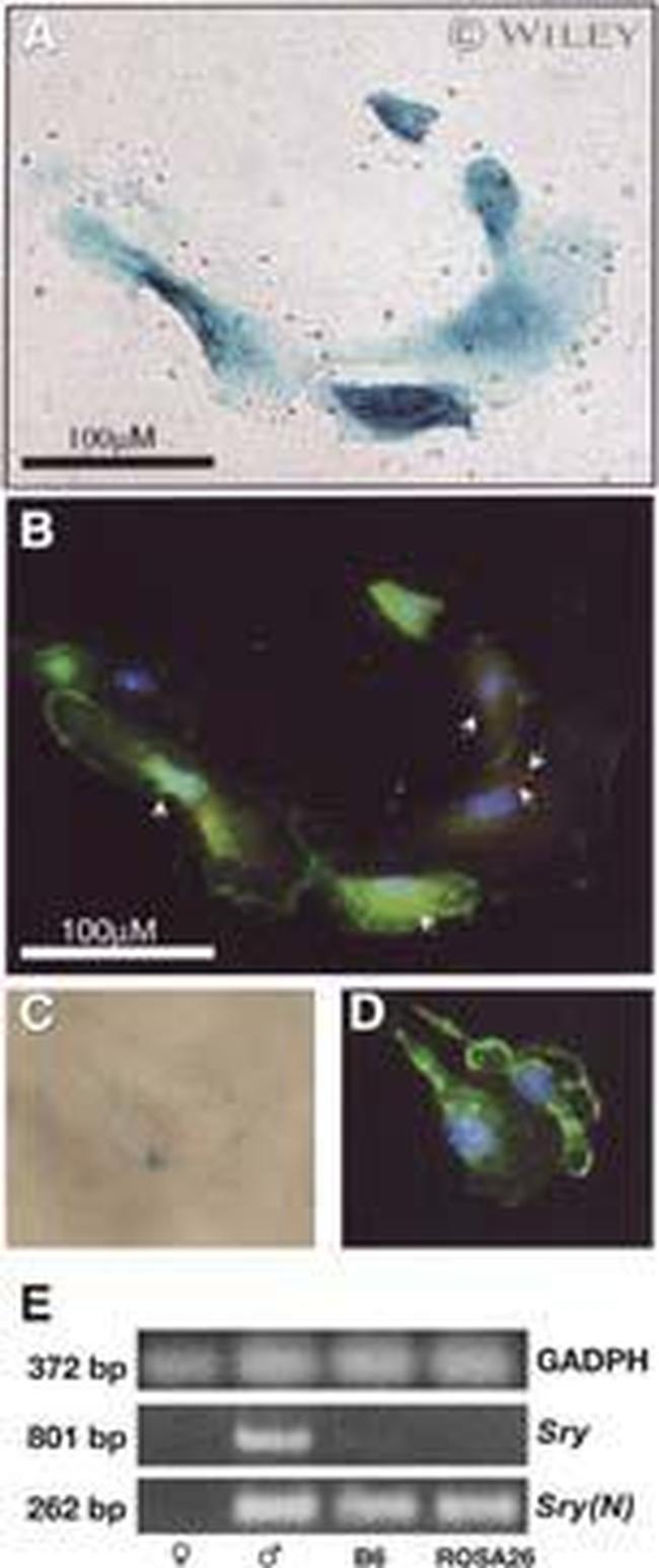 Acetyl-alpha Tubulin (Lys40) Antibody in Immunohistochemistry (IHC)