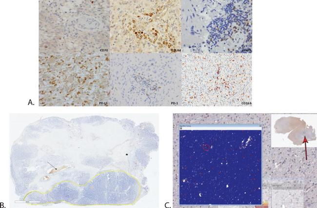 FOXP3 Antibody in Immunohistochemistry (IHC)