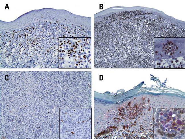 FOXP3 Antibody in Immunohistochemistry (IHC)