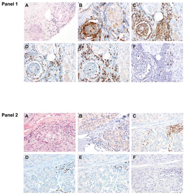 FOXP3 Antibody in Immunohistochemistry (IHC)