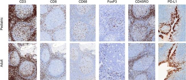 FOXP3 Antibody in Immunohistochemistry (IHC)