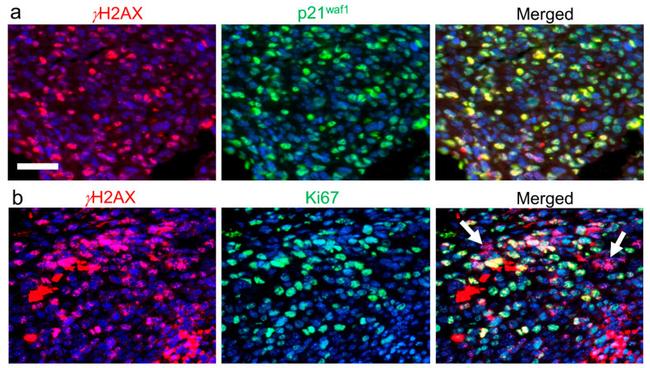 p21 Antibody in Immunocytochemistry (ICC/IF)