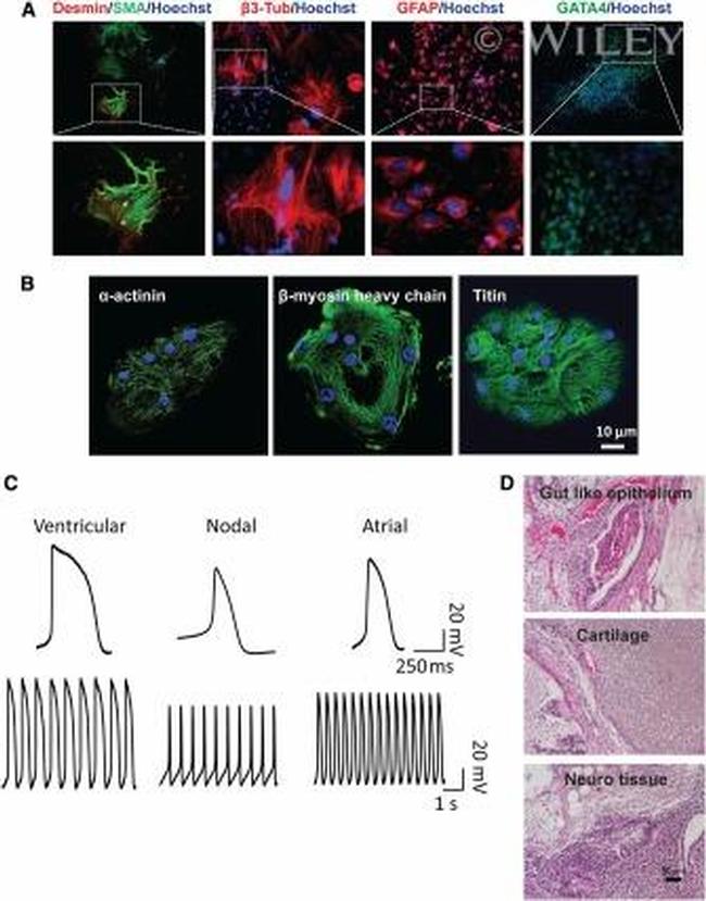 Alpha-Smooth Muscle Actin Antibody in Immunohistochemistry (IHC)