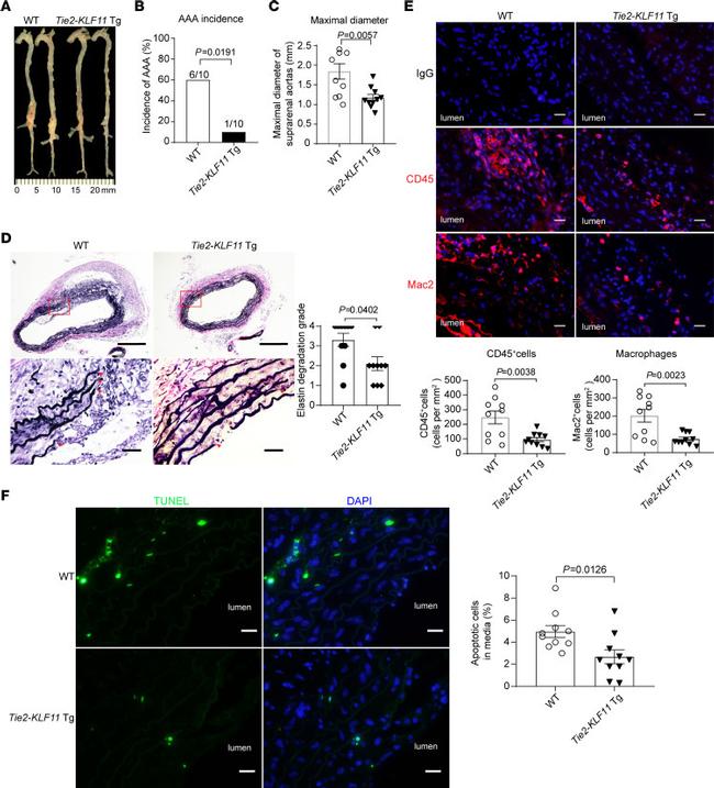 Galectin 3 Antibody in Immunocytochemistry, Immunohistochemistry (ICC/IF, IHC)