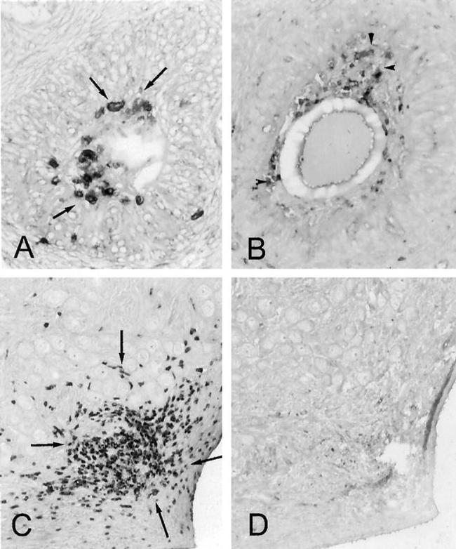 MHC Class II (I-A/I-E) Antibody in Immunohistochemistry (IHC)