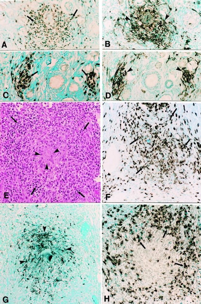 MHC Class II (I-A/I-E) Antibody in Immunohistochemistry (IHC)