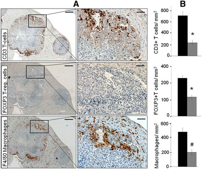 FOXP3 Antibody in Immunohistochemistry (IHC)