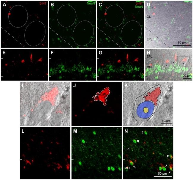 T-bet Antibody in Immunohistochemistry (IHC)