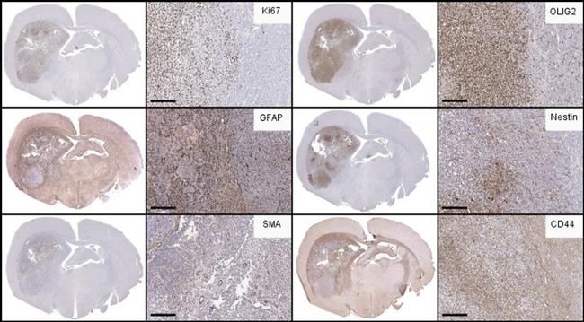 Nestin Antibody in Immunohistochemistry (Paraffin) (IHC (P))