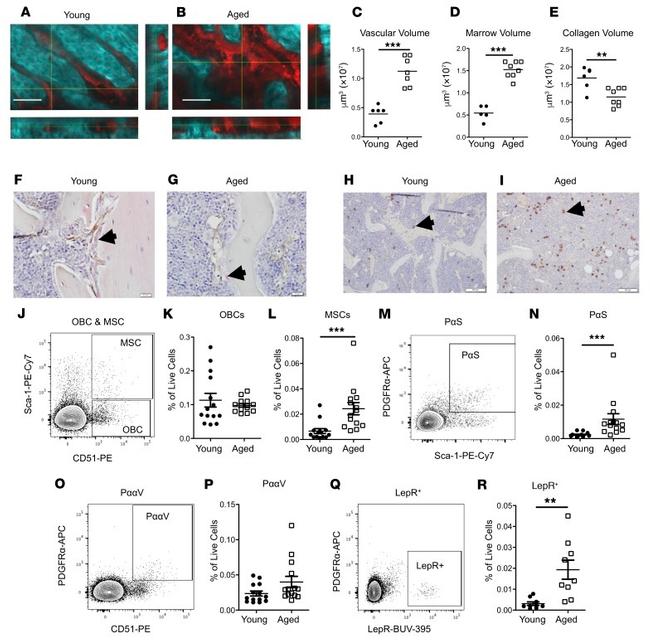 Endomucin Antibody in Immunohistochemistry (IHC)