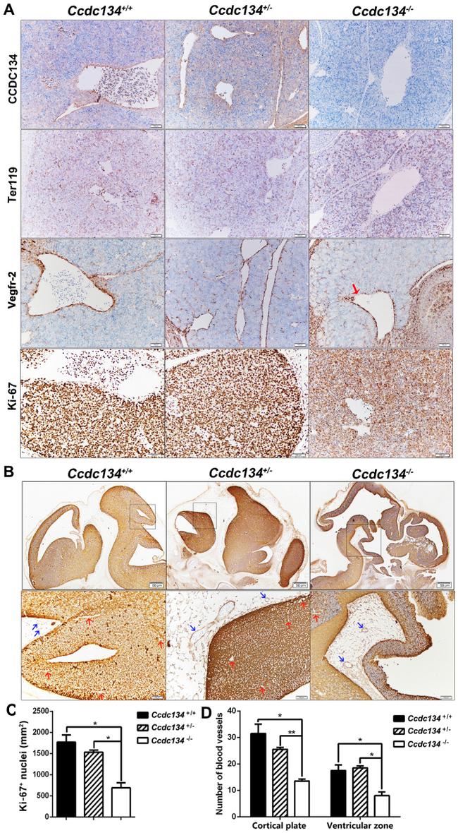 TER-119 Antibody in Immunohistochemistry (IHC)