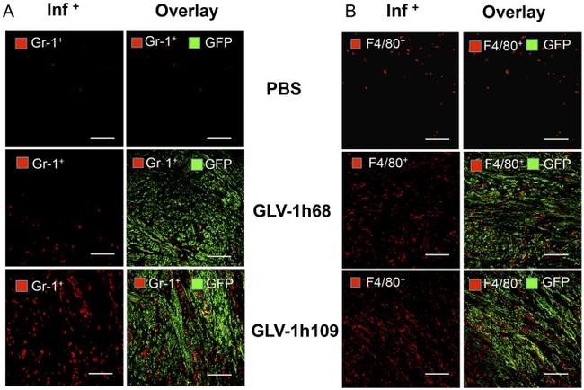 Ly-6G/Ly-6C Antibody in Immunohistochemistry (IHC)