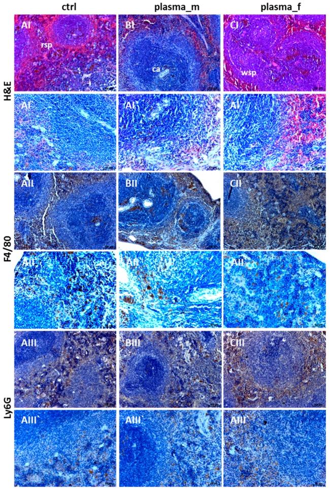 Ly-6G/Ly-6C Antibody in Immunohistochemistry (Paraffin) (IHC (P))