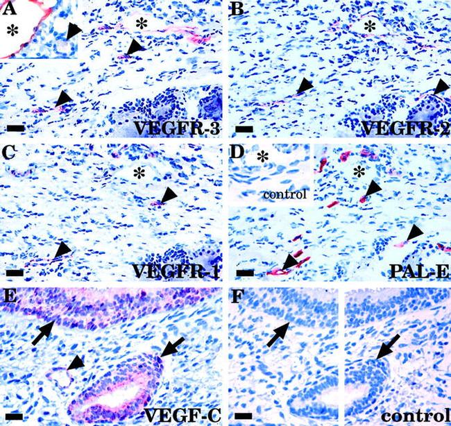 VEGF Receptor 3 Antibody in Immunohistochemistry (IHC)