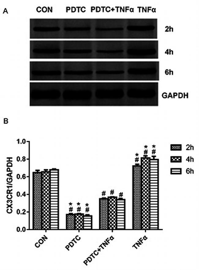 CX3CR1 Antibody in Western Blot (WB)