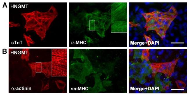 Myosin 4 Antibody in Immunocytochemistry (ICC/IF)