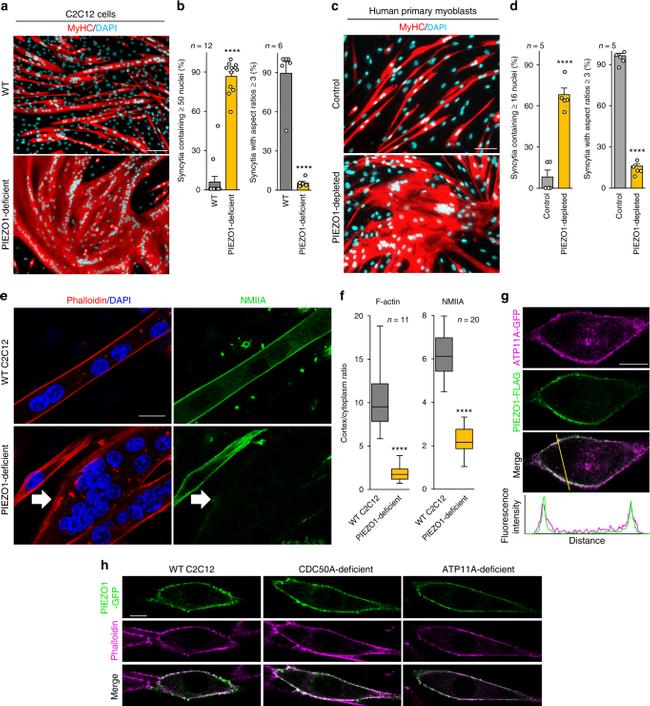 Myosin 4 Antibody in Immunocytochemistry (ICC/IF)