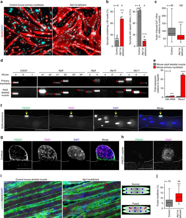 Myosin 4 Antibody in Immunocytochemistry (ICC/IF)