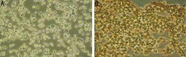 RASSF1A Antibody in Immunohistochemistry (IHC)