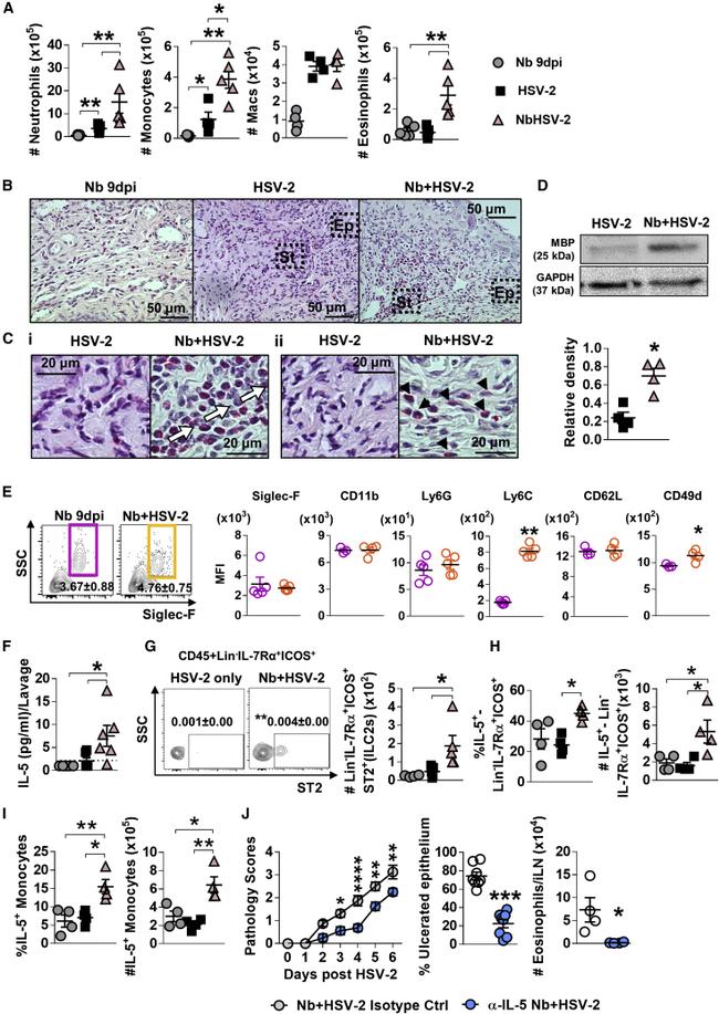 IL-5 Antibody in Neutralization (Neu)