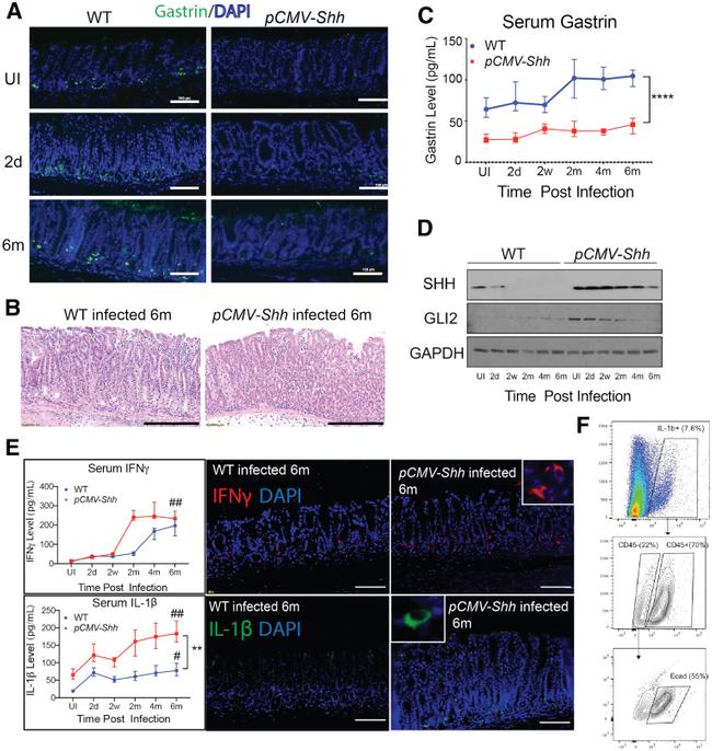 IL-1 beta (Pro-form) Antibody in Flow Cytometry (Flow)