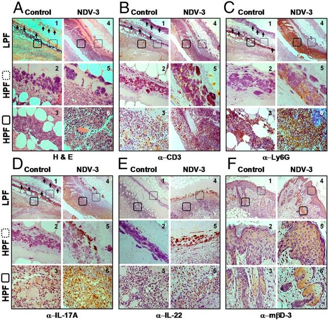 IL-22 Antibody in Immunohistochemistry (IHC)