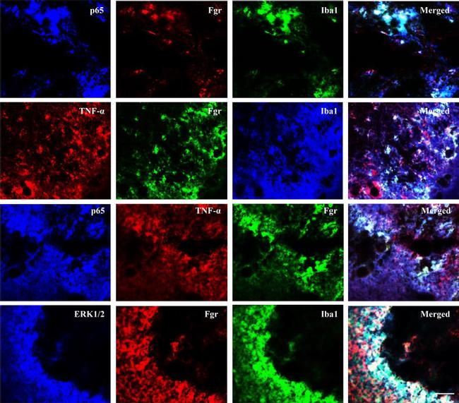 TNF alpha Antibody in Immunohistochemistry (IHC)