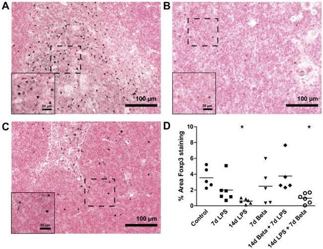 FOXP3 Antibody in Immunohistochemistry (IHC)