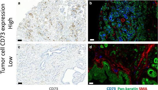 Pan Cytokeratin Antibody in Immunohistochemistry (IHC)