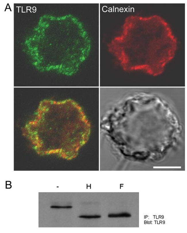 CD289 (TLR9) Antibody in Western Blot, Immunoprecipitation (WB, IP)